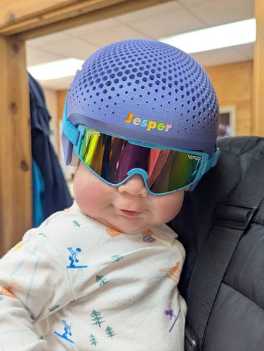 Jesper’s Custom Tallee Cranial Orthosis